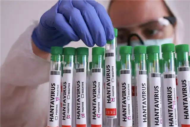 Хантавирус проявляется в двух ключевых клинических вариантах